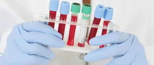 肌酐升高一定会透析？不见得，还有机会逆袭