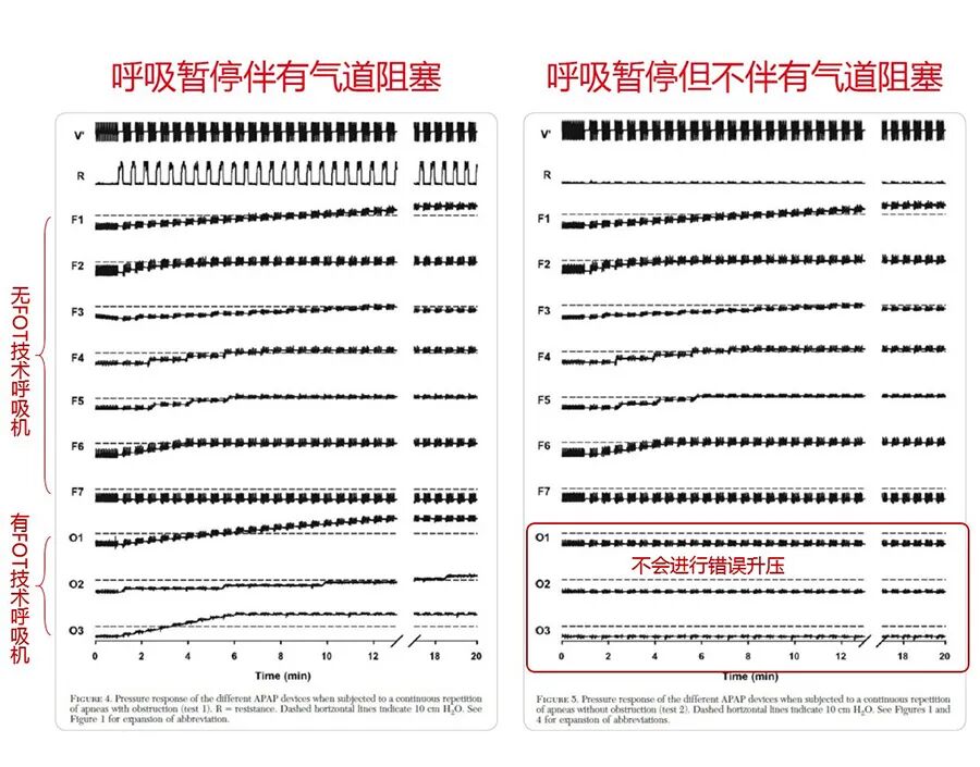 prismasmart怎么读睡眠呼吸机怎么选？律维施泰因畅销产品prismaSMART亮点揭晓_https://www.jmylbn.com_新闻资讯_第4张
