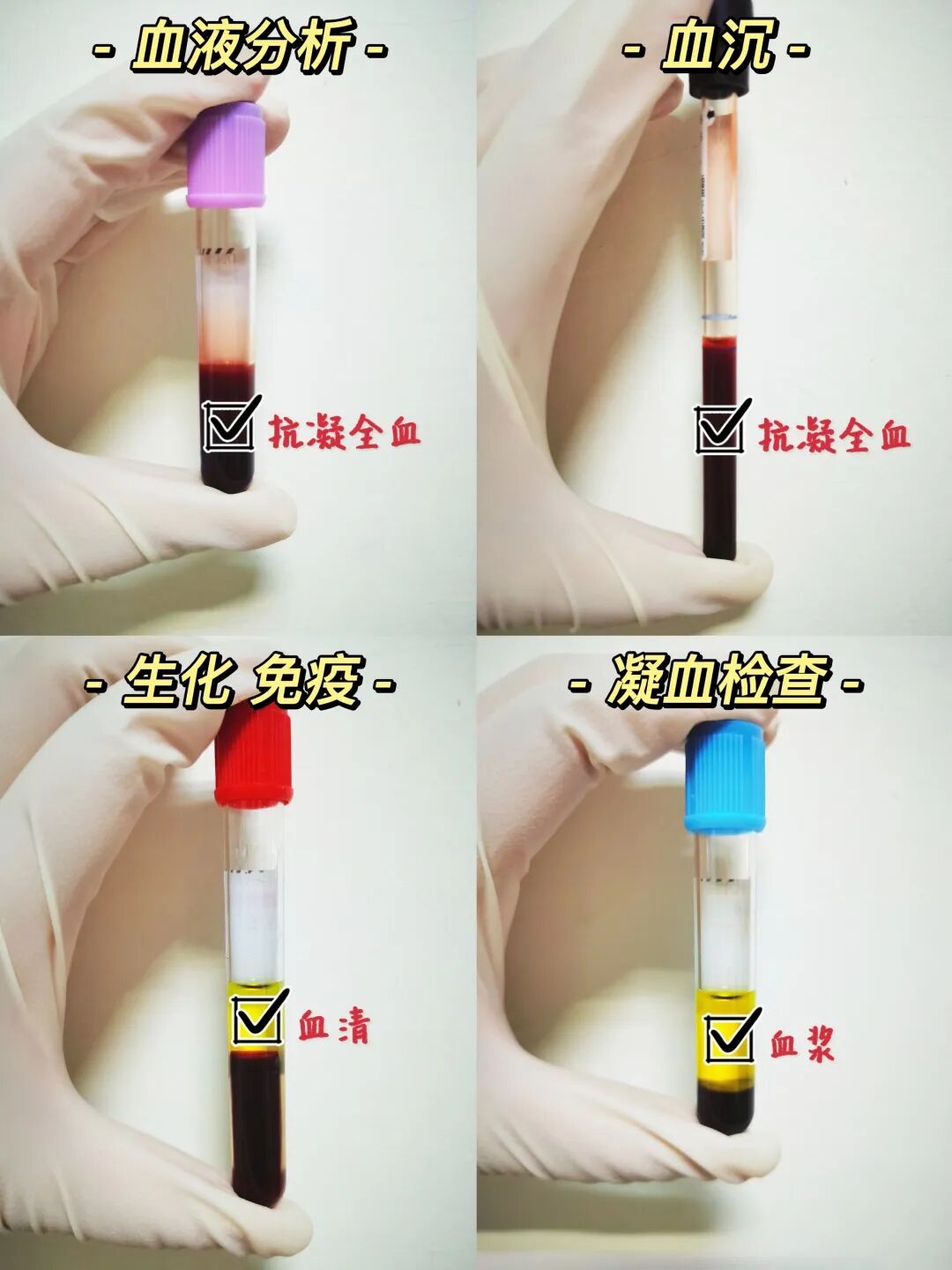 采血管颜色代表什么【二院科普】1、2、3、4、5、6、7......医生，你要把我的血抽光吗？_https://www.jmylbn.com_新闻资讯_第7张