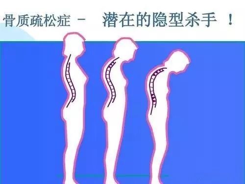 “肽”正悄悄地为身体骨骼注入钢筋水泥