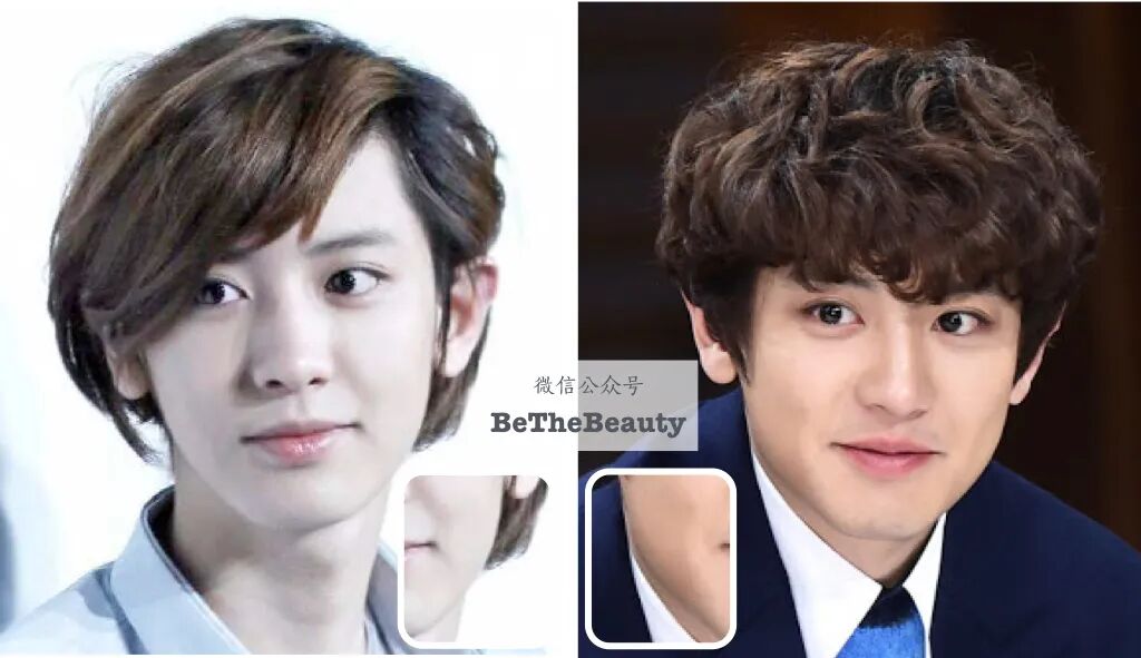 天仙也怕发腮 它是 最大颜值杀手吗 如何预防缓解 Bethebeauty 微信公众号文章阅读 Wemp