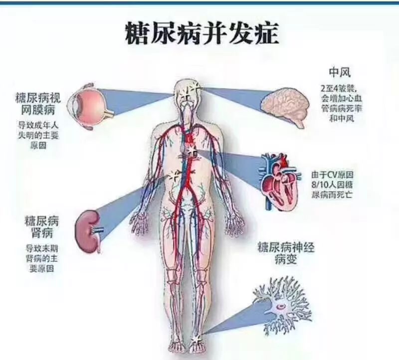 血壓忽高忽低，磨損血管壁！高血壓病人要格外警惕的4件事 健康 第4張