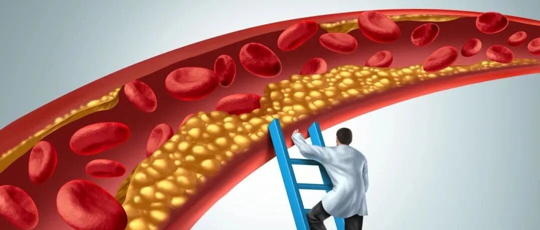 体检季 | 如何拯救你，我的血脂异常？