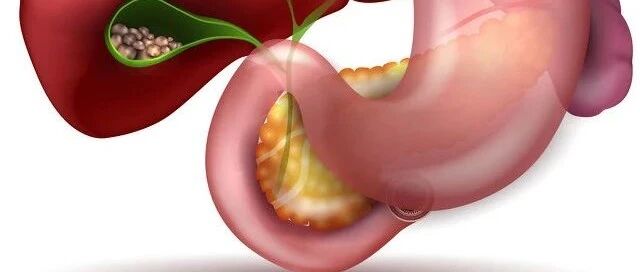 有症状的胆结石和无症状胆结石究竟是怎么回事？