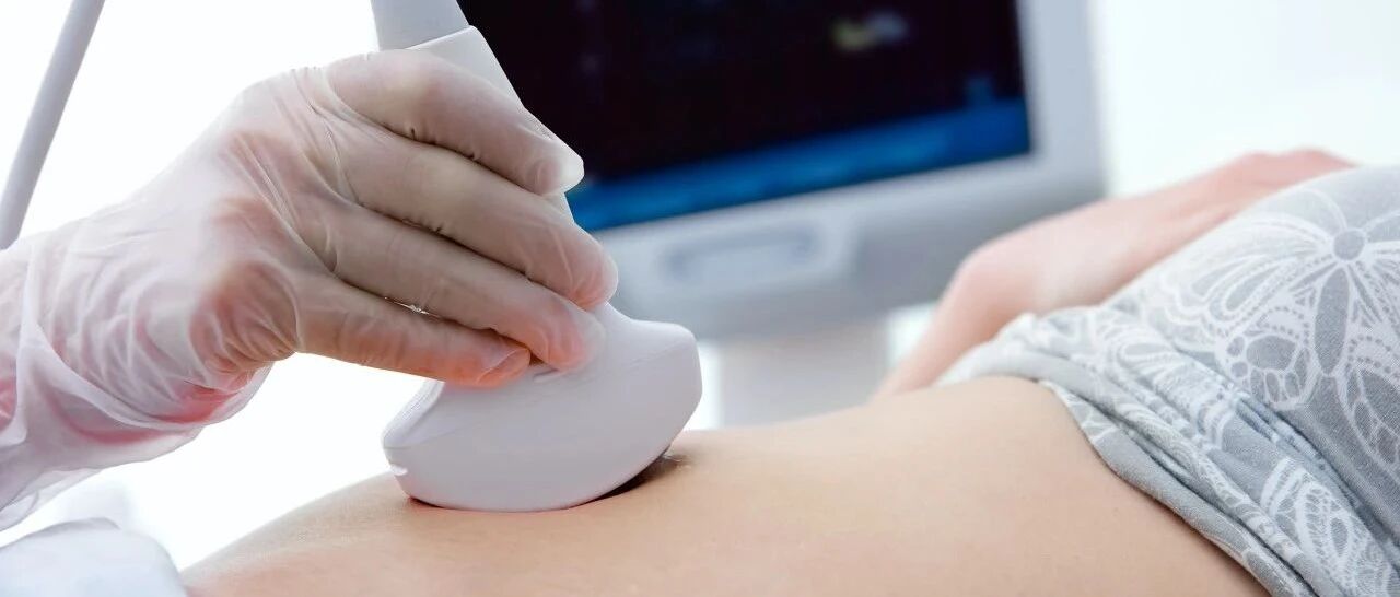 彩超“彩”在哪儿？4个问题分分钟认识它！