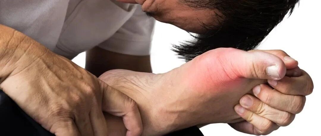 尿酸高了，痛风还会远吗？