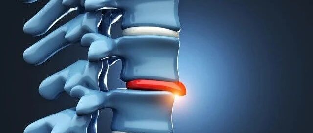 腰椎间盘突出症是如何引起的？怎么预防？