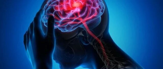 您知道什么是“无症状中风”吗？远离中风您需要这样做