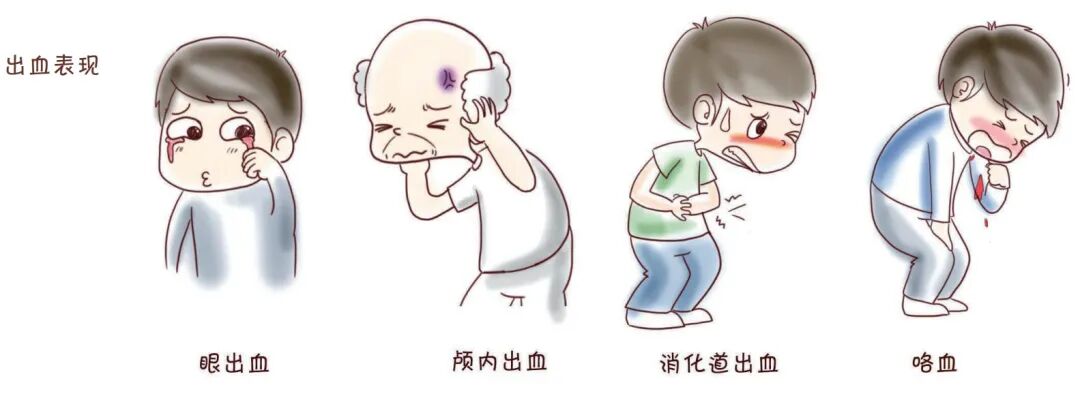 长期服用抗凝血药需要注意些什么