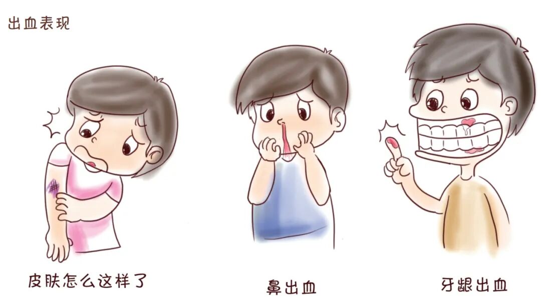 长期服用抗凝血药,需要注意些什么?