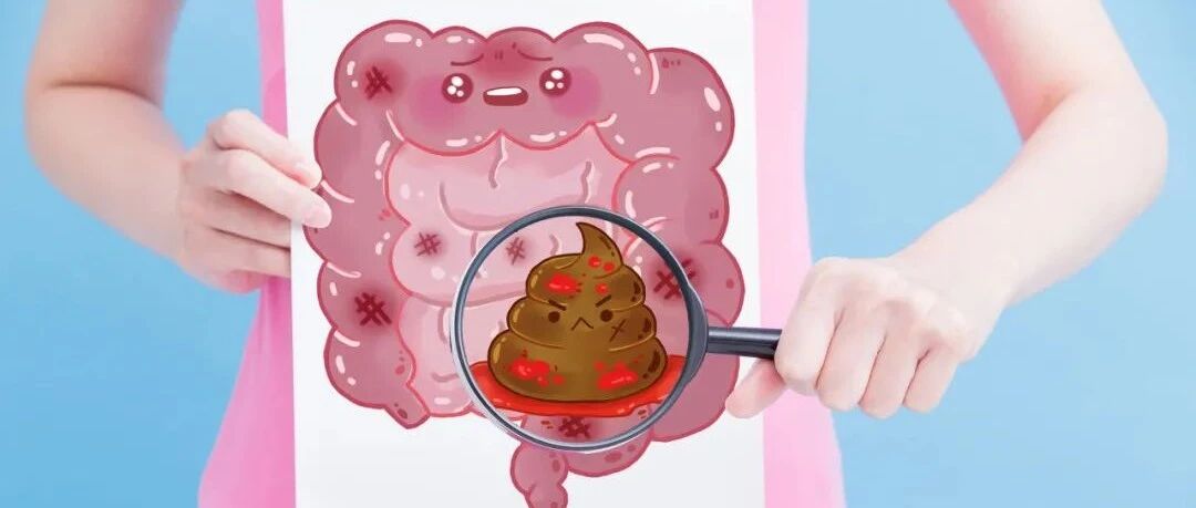 体检查出便便有血就是肠癌吗？身体出现哪些症状要警惕结直肠癌？