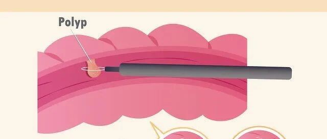 出现结节、息肉、囊肿、增生怎么办？