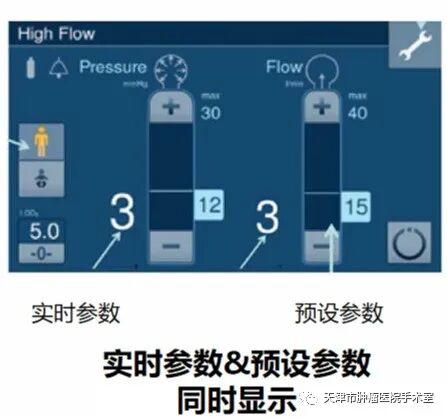 气腹管怎么接谁说手术室护士只会递器械，来大家一起聊聊腹腔镜手术中CO2气腹管理_https://www.jmylbn.com_新闻资讯_第2张