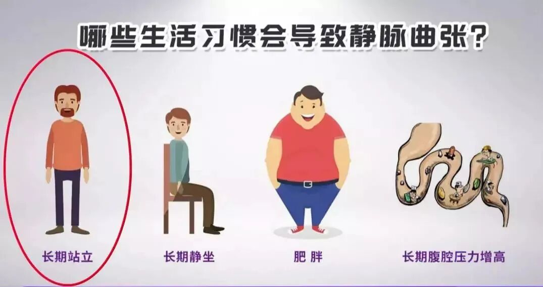 熏蒸床怎么用视频科普视频｜从“蚯蚓腿”到“老烂腿”，静脉曲张不得不说的那些事_https://www.jmylbn.com_新闻资讯_第5张