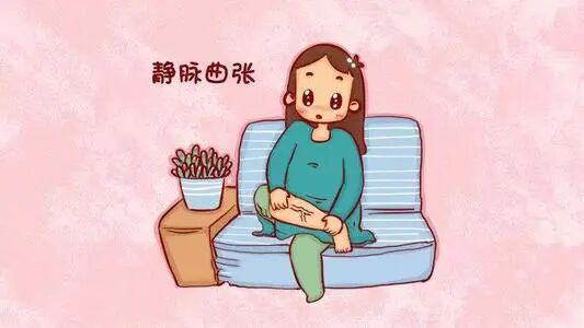 熏蒸床怎么用视频科普视频｜从“蚯蚓腿”到“老烂腿”，静脉曲张不得不说的那些事_https://www.jmylbn.com_新闻资讯_第4张