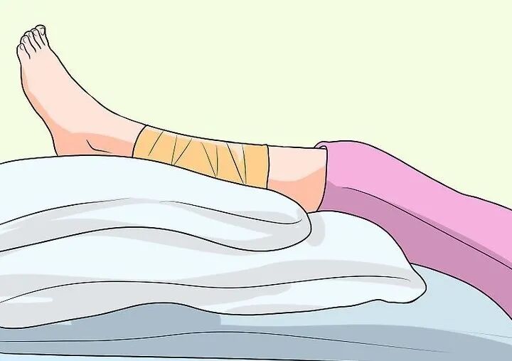 熏蒸床怎么用视频科普视频｜从“蚯蚓腿”到“老烂腿”，静脉曲张不得不说的那些事_https://www.jmylbn.com_新闻资讯_第7张