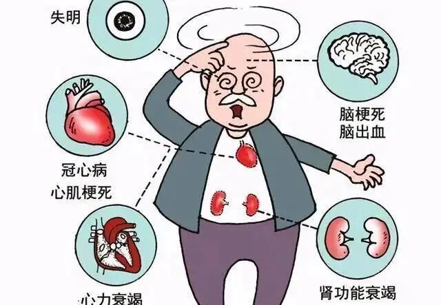 三氧疗法怎么代理预防脑出血@试试三氧自体血免疫疗法！_https://www.jmylbn.com_新闻资讯_第1张