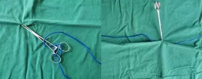 为什么手术用电刀手术中使用高频电刀原来还有这么多讲究，看看掌握了几点？_https://www.jmylbn.com_新闻资讯_第6张