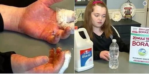 "水晶泥"走红小学校园,内含可致命毒硼砂!