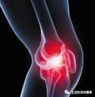 滑膜炎“最怕”2味中药，熬水喝掉，行气活血，缓解疼痛，去积液