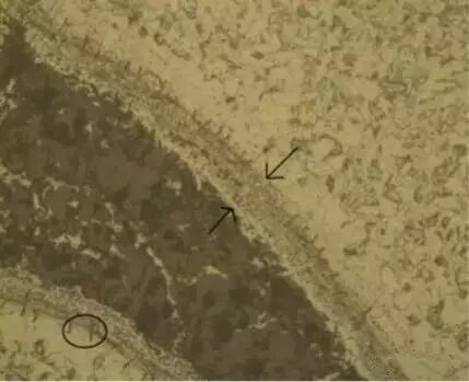 如何区分锻造裂纹、热处理裂纹、原材料裂纹？的图2