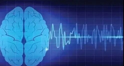 动态脑电图怎么看如何做动态脑电图【成都名医指导】_https://www.jmylbn.com_新闻资讯_第7张