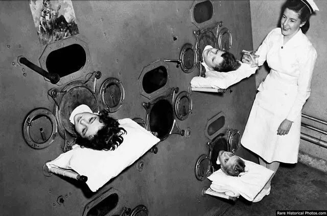 上世纪50年代,小儿麻痹症患者住在“铁肺”(IRON LUNG,一种人工呼吸器)里