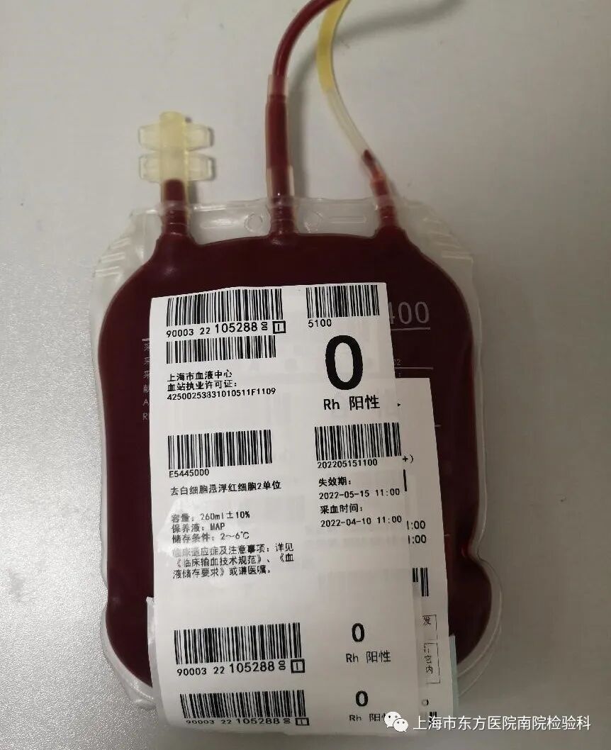 红细胞滤器怎么用血液“滤白”，您了解吗？_https://www.jmylbn.com_新闻资讯_第4张