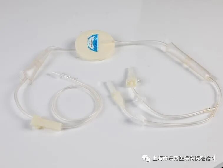 红细胞滤器怎么用血液“滤白”，您了解吗？_https://www.jmylbn.com_新闻资讯_第14张