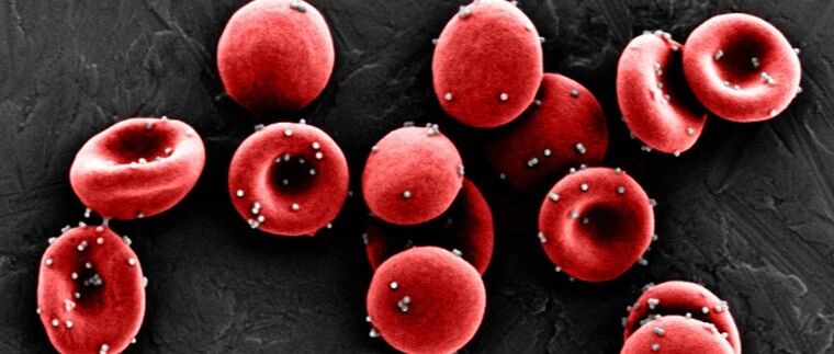 |观点|新冠疫情期间癌症患者合并感染风险高，治疗效果差