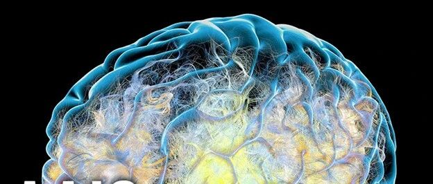 |必看|最新报告40%阿兹海默症可以预防或延缓发病