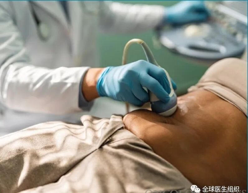 高风险个体胰腺癌病变液体活检进展及其健康获益