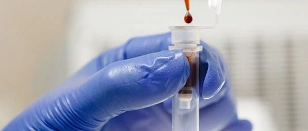 癌症液体活检方法将上市，专家说至少还需要十年时间