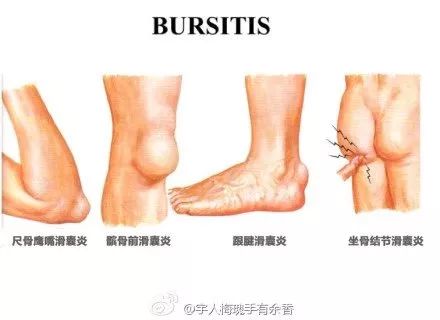 32.肌腱（tendons）和韧带（ligaments）的区别33.腰椎韧带34.足下那些病35.骨骼肌
