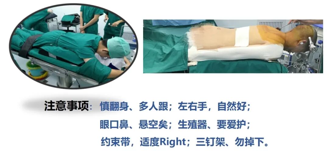 手术室体位垫怎么用手术室里的＂趴睡＂学问：俯卧位摆放全解析_https://www.jmylbn.com_新闻资讯_第10张