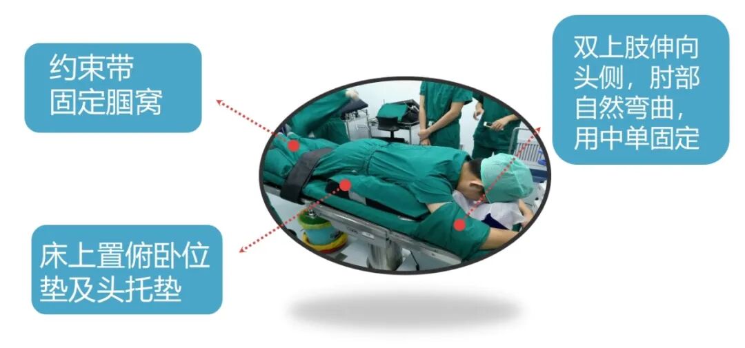 手术室体位垫怎么用手术室里的＂趴睡＂学问：俯卧位摆放全解析_https://www.jmylbn.com_新闻资讯_第9张