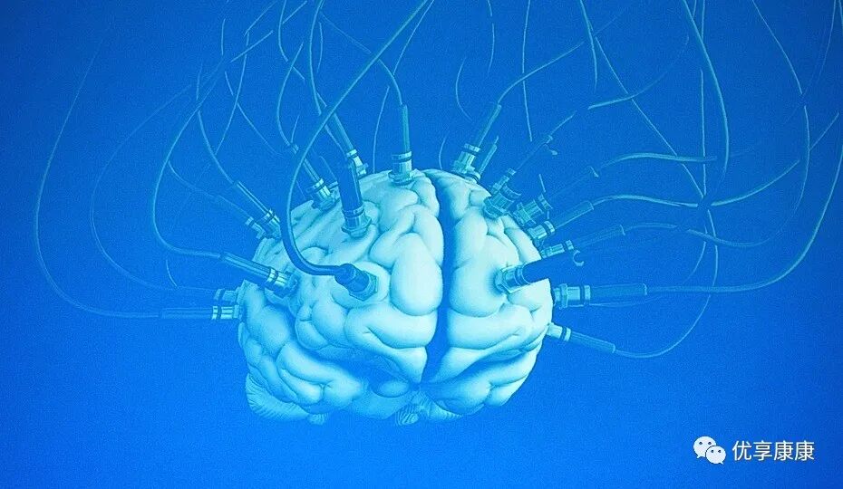 tms什么医疗康复基础 ｜ 重复经颅磁刺激(TMS)治疗专家共识，点击共识！_https://www.jmylbn.com_新闻资讯_第4张