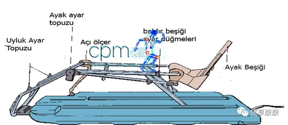 怎么调节cpm康复机CPM在骨科康复的作用_https://www.jmylbn.com_新闻资讯_第5张