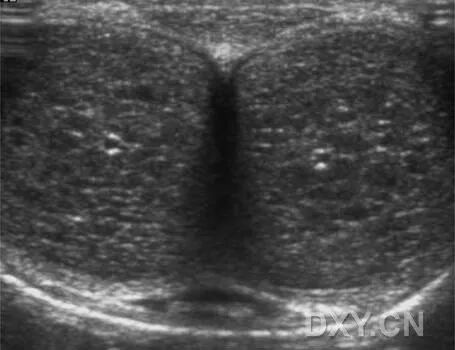 阴茎多普勒检查什么阴茎彩色多普勒超声检查_https://www.jmylbn.com_新闻资讯_第3张