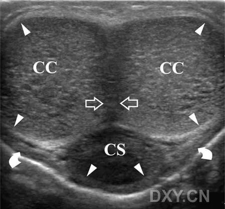 阴茎多普勒检查什么阴茎彩色多普勒超声检查_https://www.jmylbn.com_新闻资讯_第4张