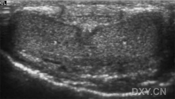 阴茎多普勒检查什么阴茎彩色多普勒超声检查_https://www.jmylbn.com_新闻资讯_第1张