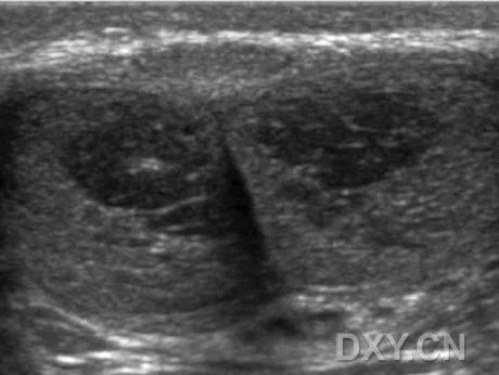 阴茎多普勒检查什么阴茎彩色多普勒超声检查_https://www.jmylbn.com_新闻资讯_第2张