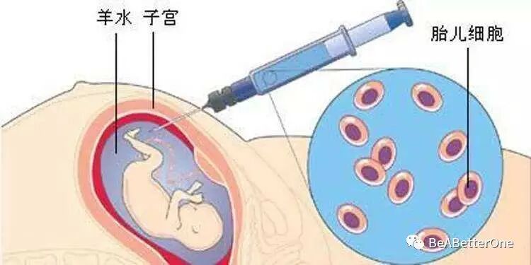 无创建议做基础班还是升级版_无创建议做几项指标的_不建议做无创plus