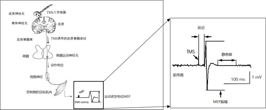 tms什么医疗神经调控——TMS技术，你get到了吗_https://www.jmylbn.com_新闻资讯_第8张