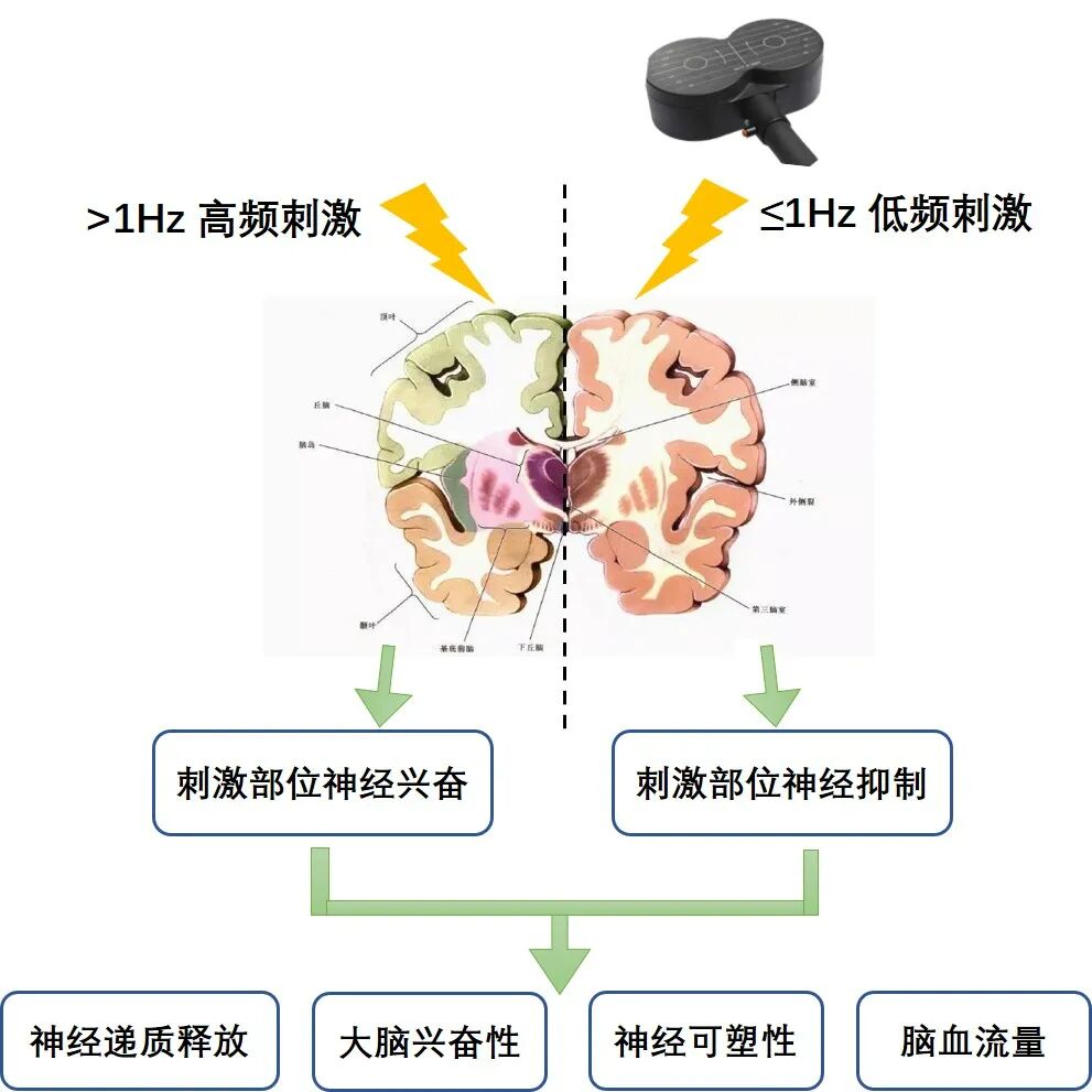 tms什么医疗神经调控——TMS技术，你get到了吗_https://www.jmylbn.com_新闻资讯_第9张