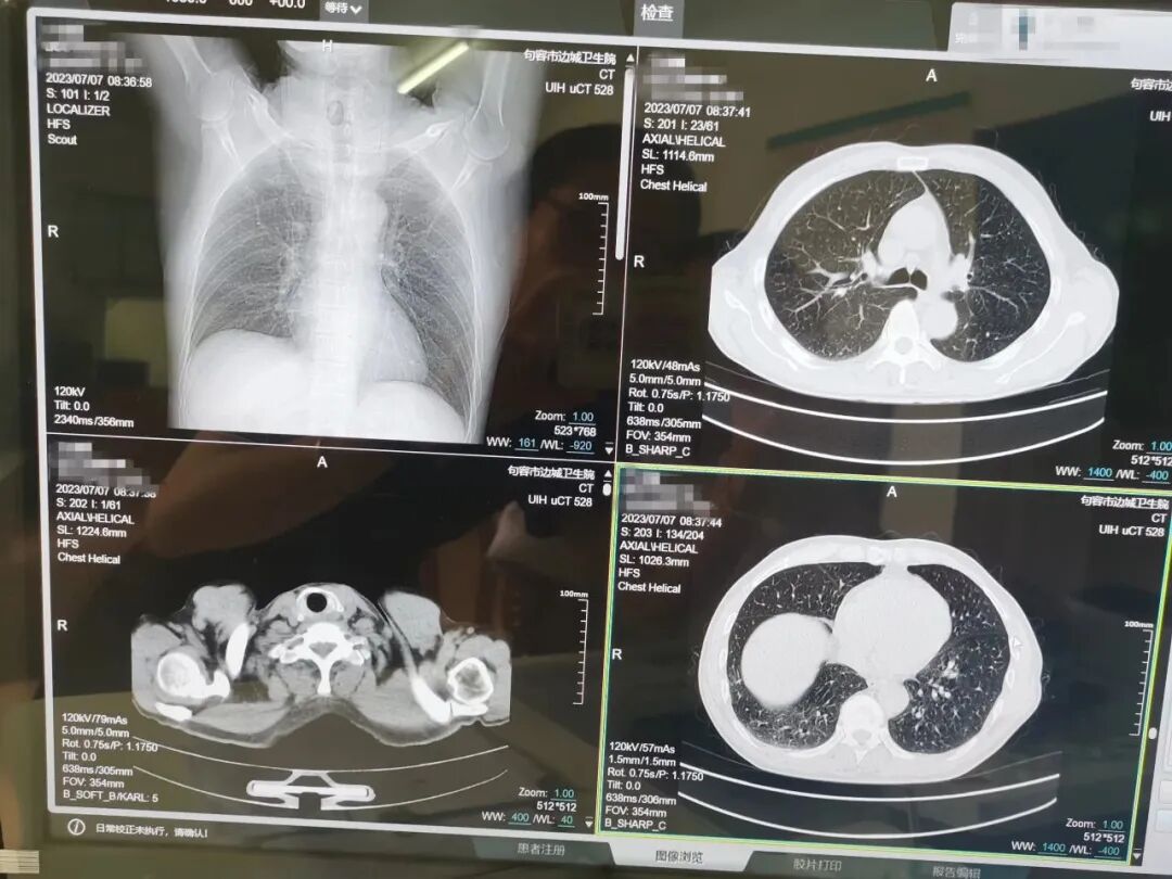 联影ct怎么样我院又添新“利器”——联影40排高端螺旋CT正式投入使用！_https://www.jmylbn.com_新闻资讯_第6张