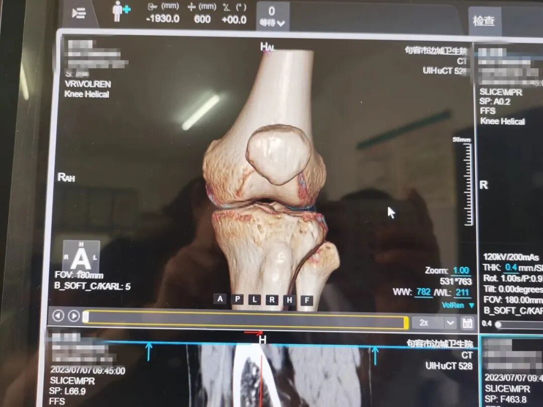 联影ct怎么样我院又添新“利器”——联影40排高端螺旋CT正式投入使用！_https://www.jmylbn.com_新闻资讯_第7张