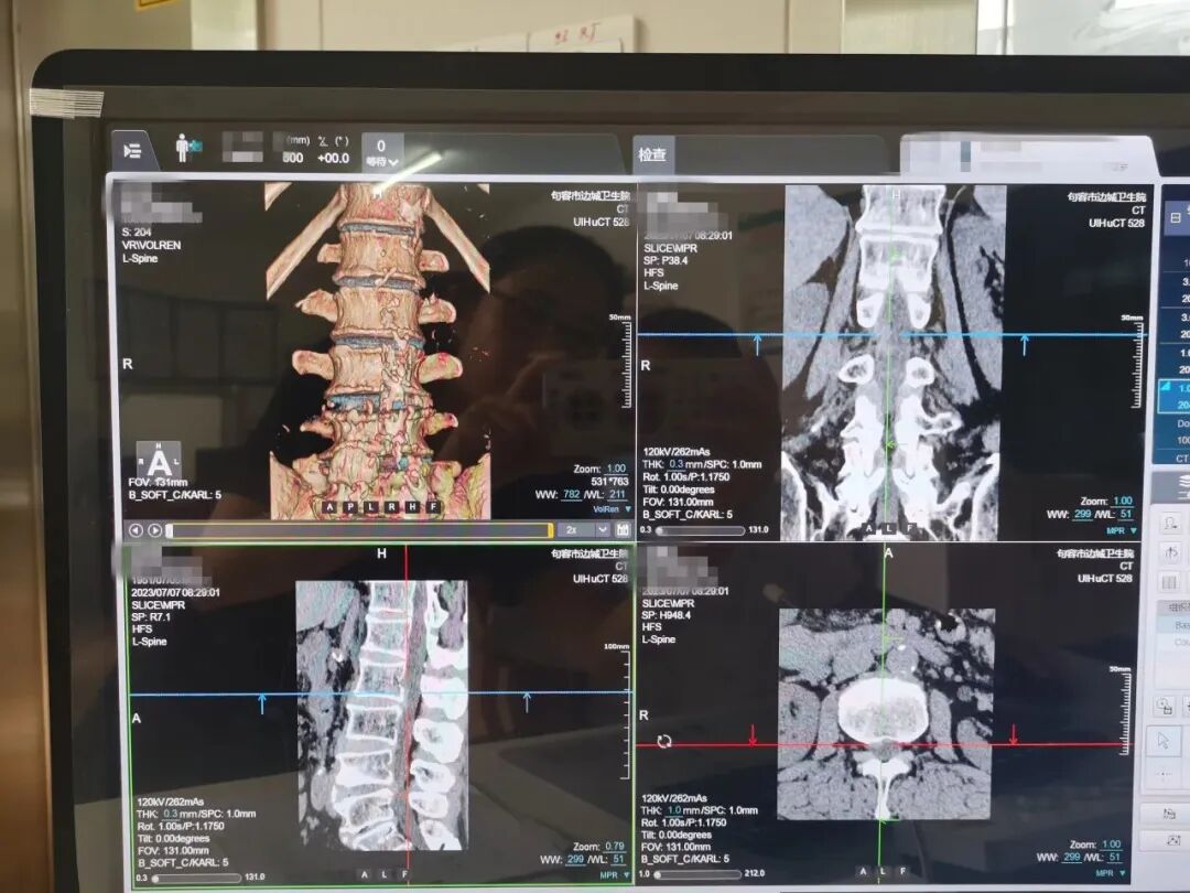 联影ct怎么样我院又添新“利器”——联影40排高端螺旋CT正式投入使用！_https://www.jmylbn.com_新闻资讯_第8张