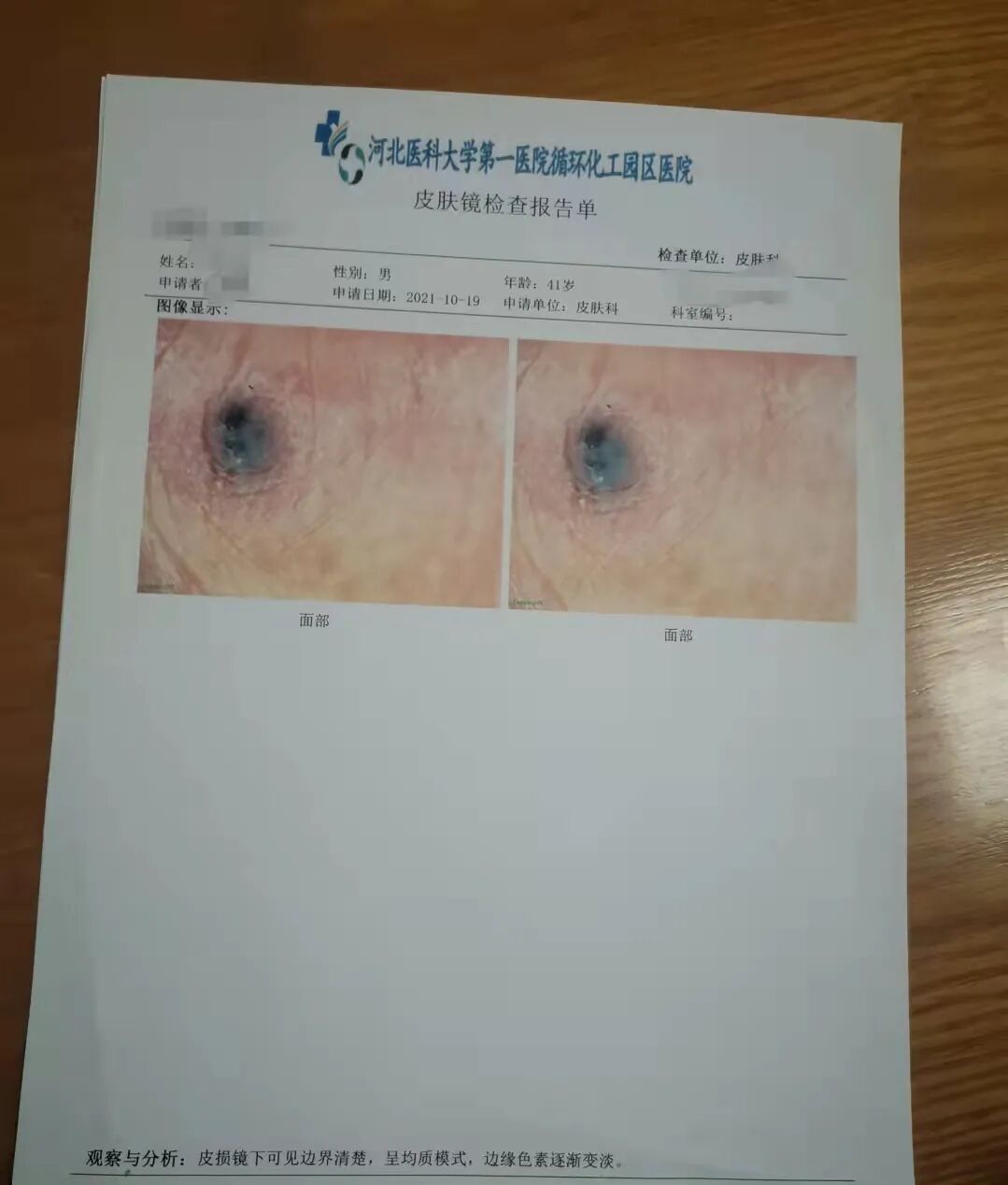 医用皮肤镜什么牌子好长痣、红肿、瘙痒、脱发......感觉自己得了皮肤病？皮肤镜检查为您一探究竟！_https://www.jmylbn.com_新闻资讯_第3张