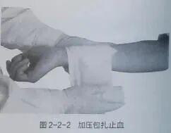 医用绷带为什么能止血【金豆培训】为外伤出血的患者包扎止血_https://www.jmylbn.com_新闻资讯_第3张